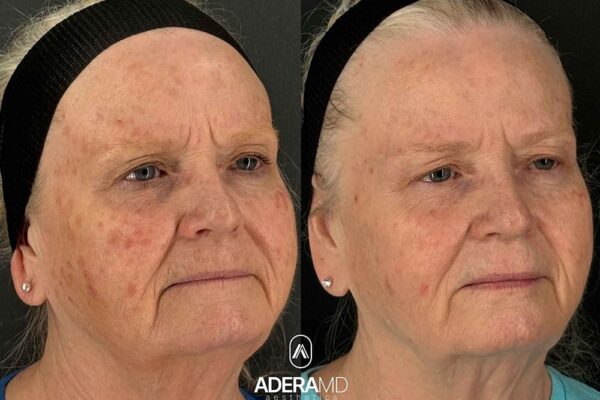 Gray B&A (45)
