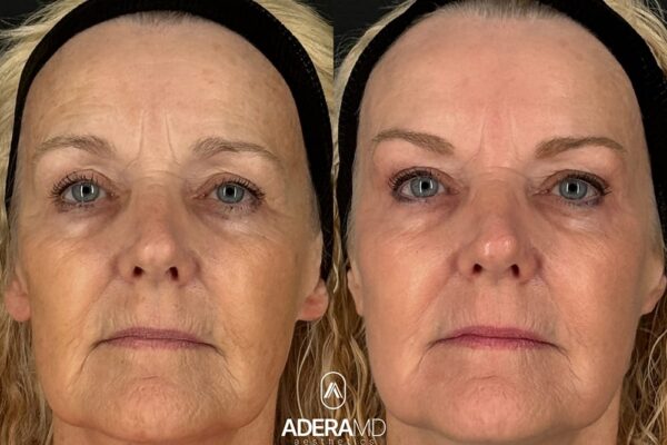 Rickle B&A